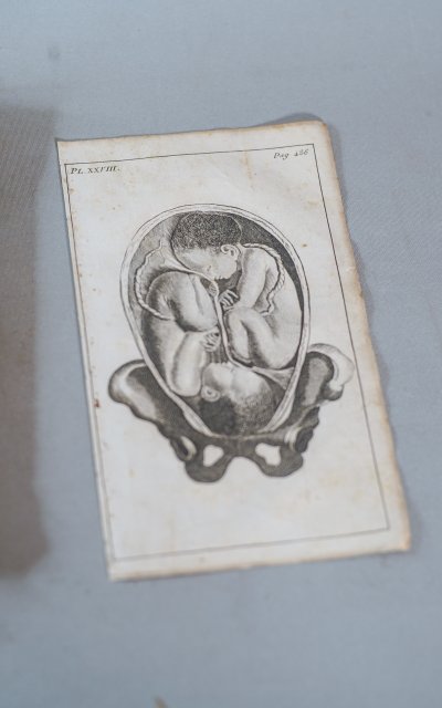 SAGE-FEMME, J-L. BAUDELOCQUE, Principles on the art of childbirth