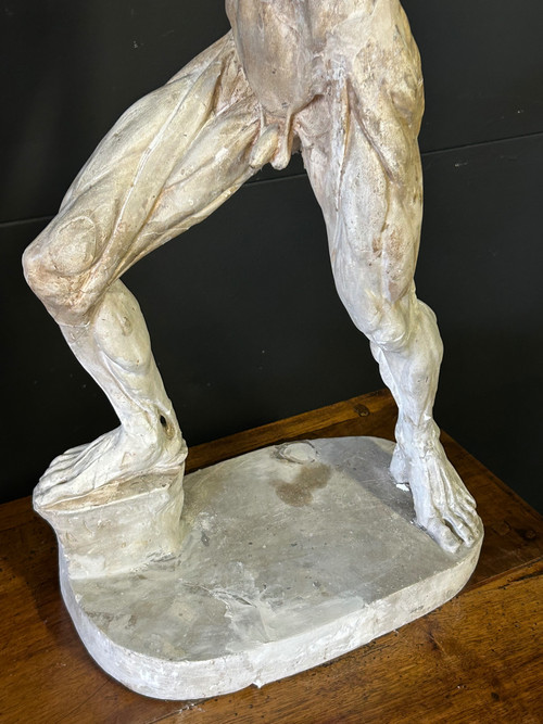 Jacques - Eugène Caudron ( 1818-1865) D'après - Sculpture écorché En Plâtre Cabinet Curiosité