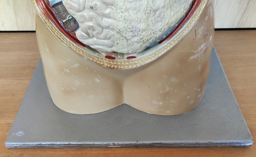Ancien Écorché De Médecine