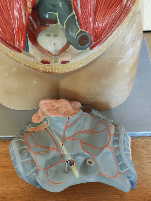 Ancien Écorché De Médecine