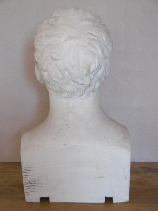 Bust Of Baron Dupuytren
