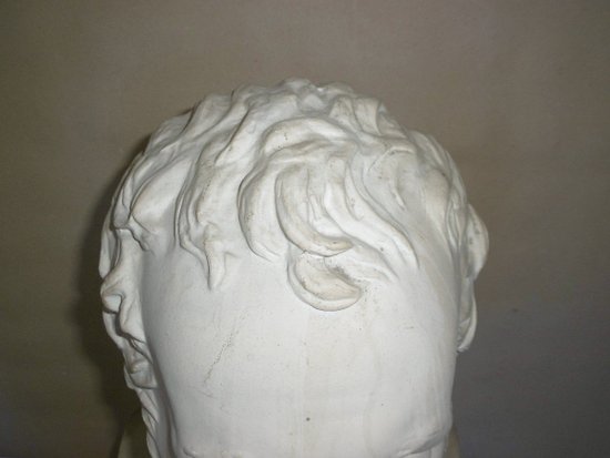 Bust Of Baron Dupuytren