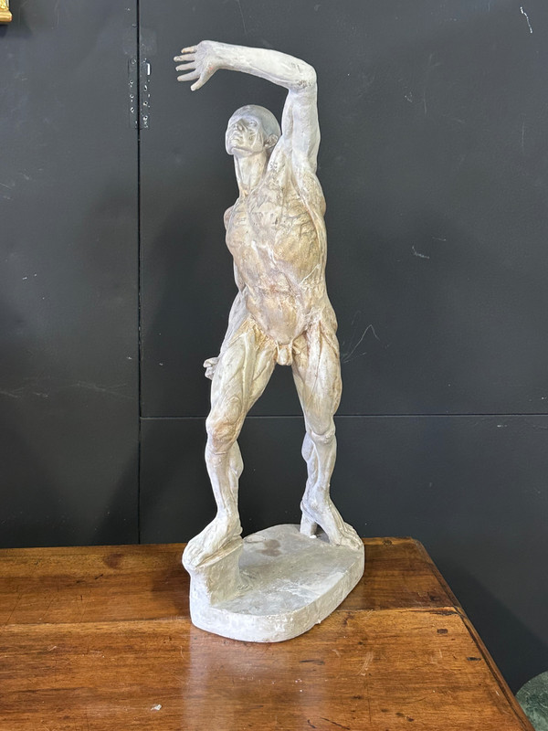 Jacques - Eugène Caudron ( 1818-1865) D'après - Sculpture écorché En Plâtre Cabinet Curiosité