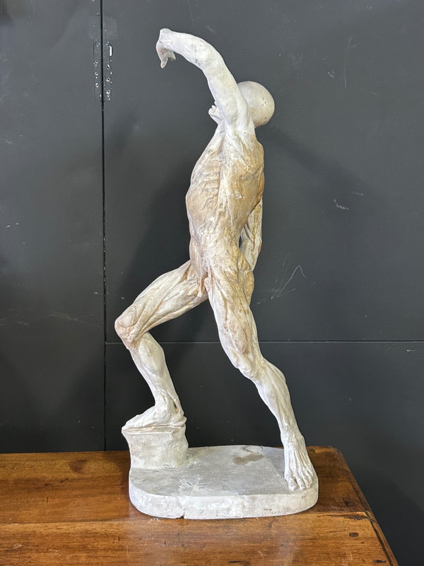 Jacques - Eugène Caudron ( 1818-1865) D'après - Sculpture écorché En Plâtre Cabinet Curiosité
