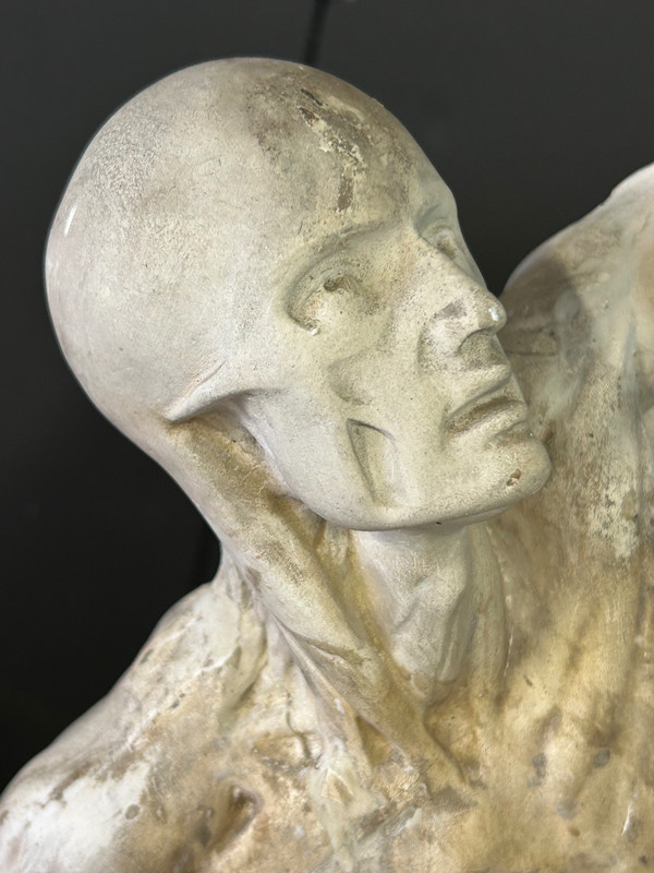 Jacques - Eugène Caudron ( 1818-1865) D'après - Sculpture écorché En Plâtre Cabinet Curiosité